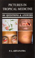 Pictures in Tropical Medicine : 101 Questions & Answers